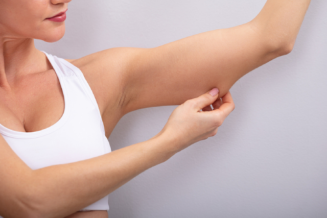 Weight Loss: Effective Ways to Lose Stubborn Arm Fat